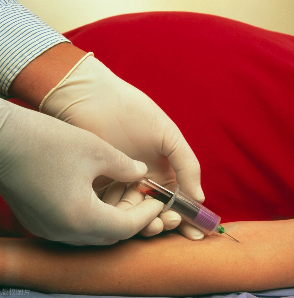 重磅必看：孕期血常规，九成姐妹其实真看不懂