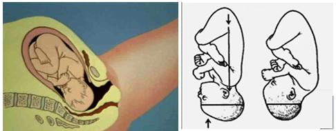 胎儿屁股在右侧是什么胎位,胎位roa屁股在左边还是右边