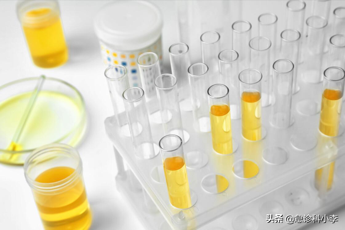 12岁女孩患尿毒症每天坚持透析,妈妈患尿毒症透析