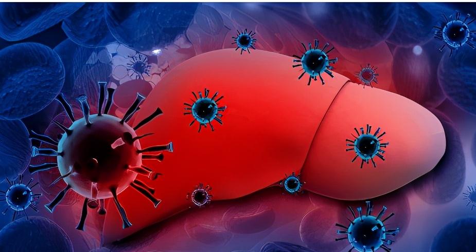 胆红素偏高怎么降,胆红素过高怎么降低