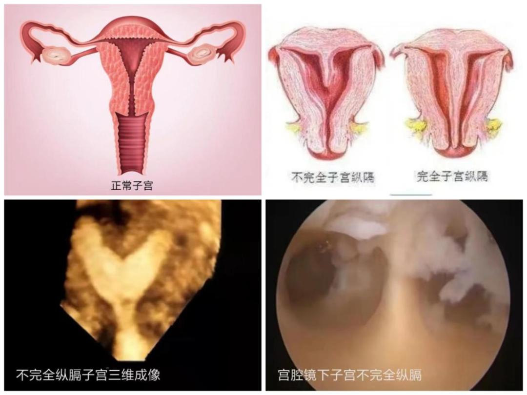 一室变两室采光,夫妻身体正常为何屡屡流产