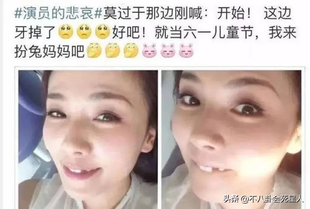 烤瓷牙有多恐怖,烤瓷牙害我一生