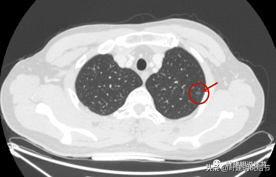 医生为了预防医患矛盾过度诊疗,医院过度医疗手术