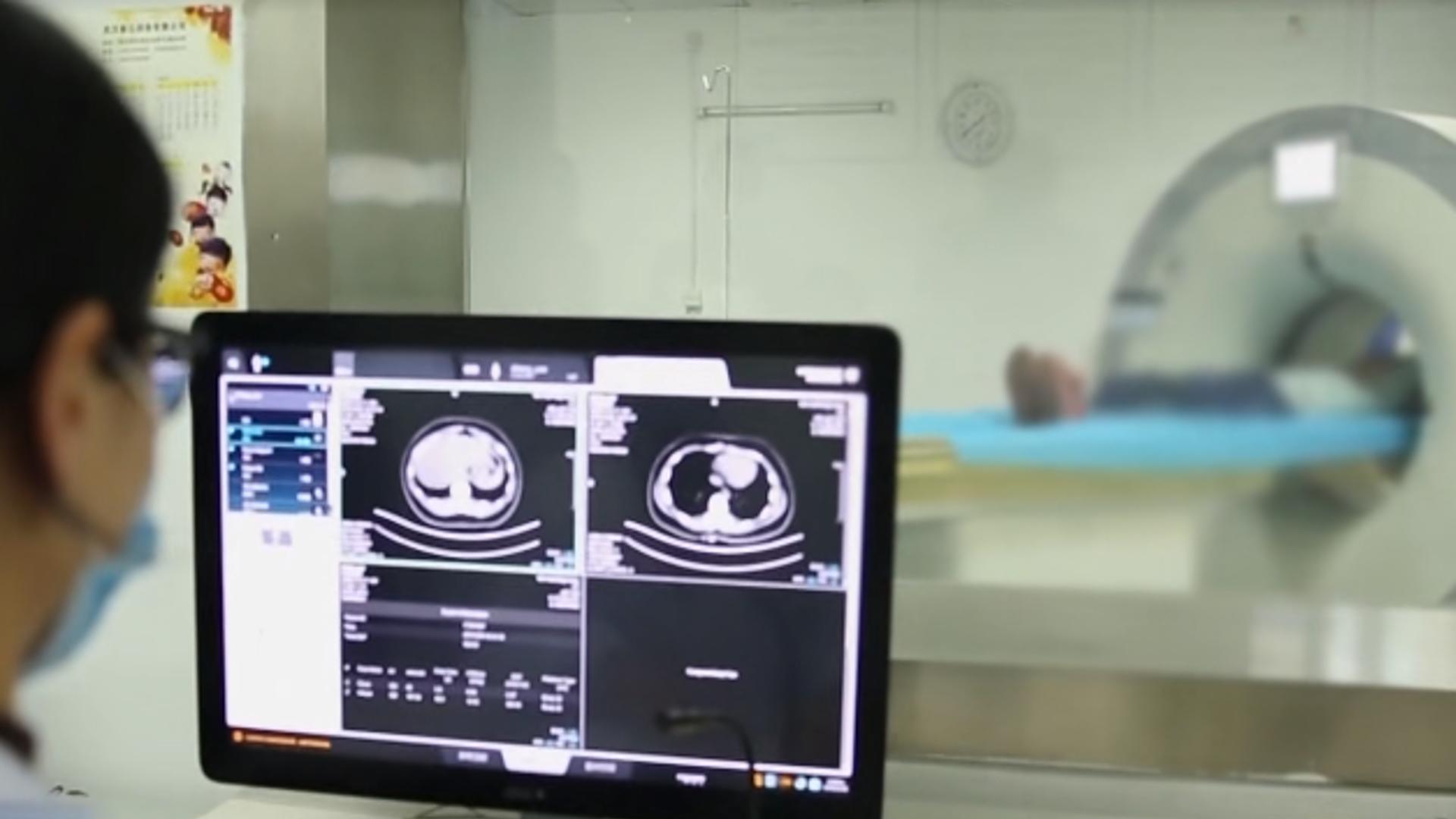 20岁女孩查出糖尿病,杭州17岁少女得了糖尿病