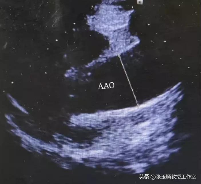 咳嗽不停该咋办导致晕厥,反复咳嗽一个月了是什么原因