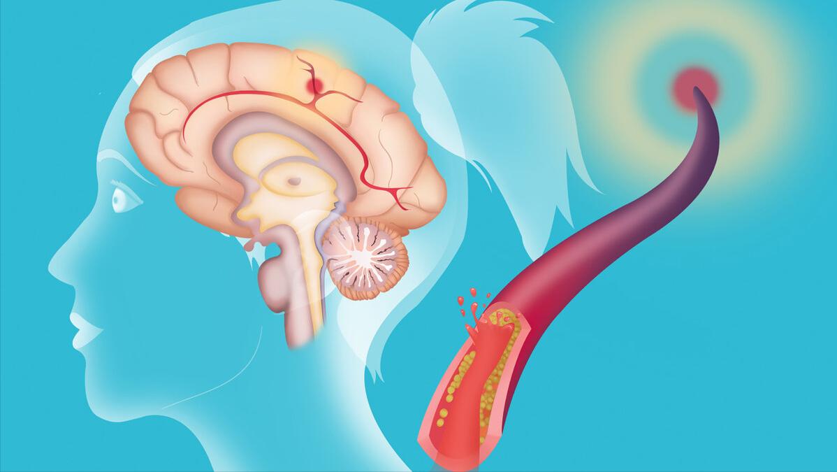 低压高是什么原因和危害,低压高的原因及危害