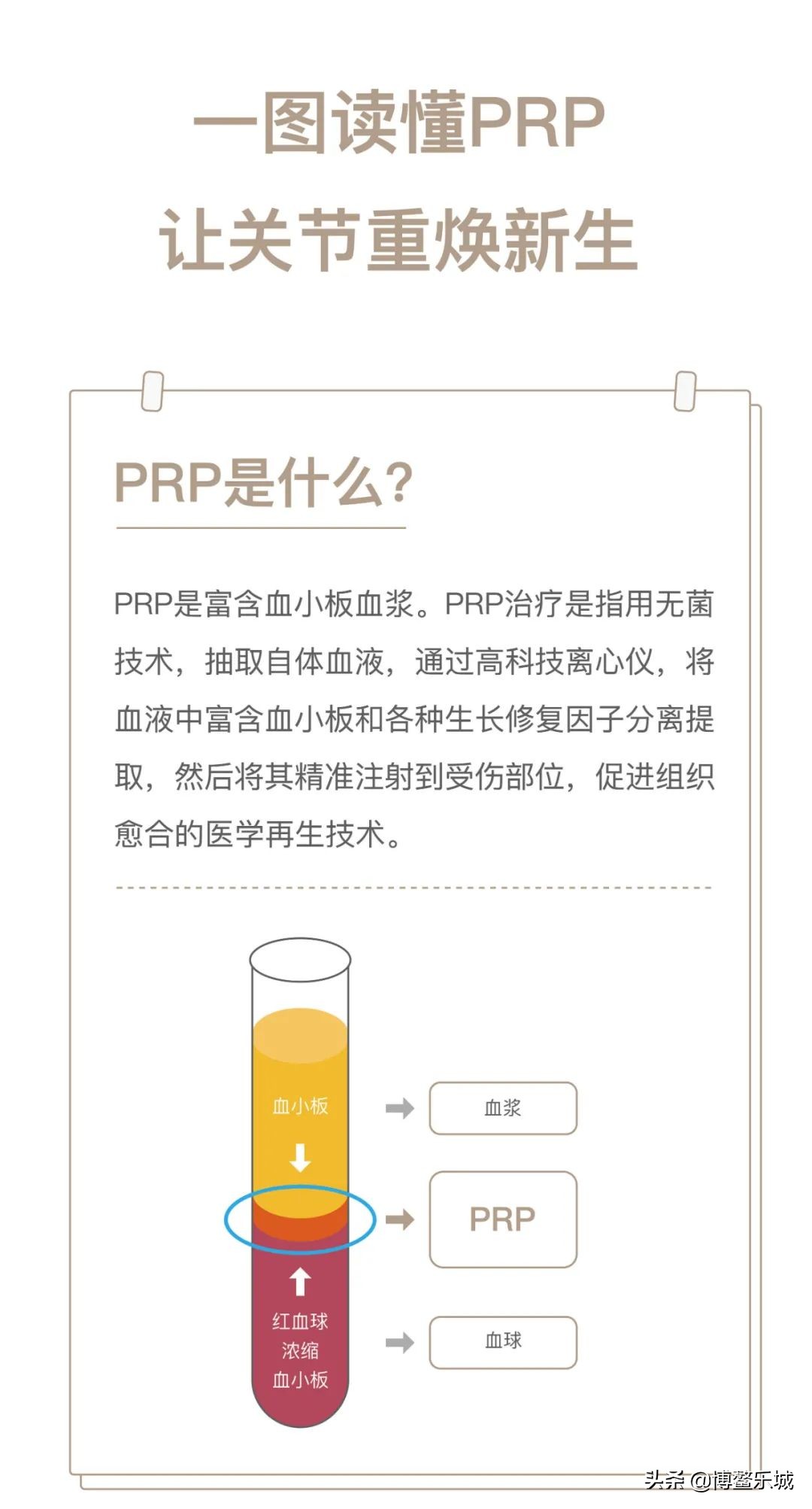 无需手术，乐城颖奕PRP注射治疗让深受膝关节炎苦痛多年的患者告别了轮椅……