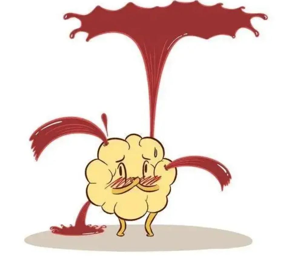 盆腔积液=盆腔炎？不要被它吓破了胆，范主任给你讲清楚、调正常