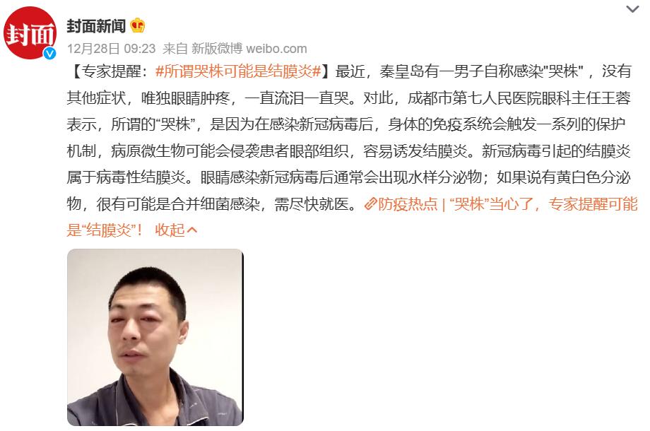 结膜炎一直流眼泪视线模糊,结膜炎好了总是流眼泪怎么回事