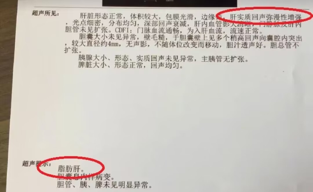 肝实质回声增粗就是肝衰竭吗,肝实质回声增粗是乙肝吗