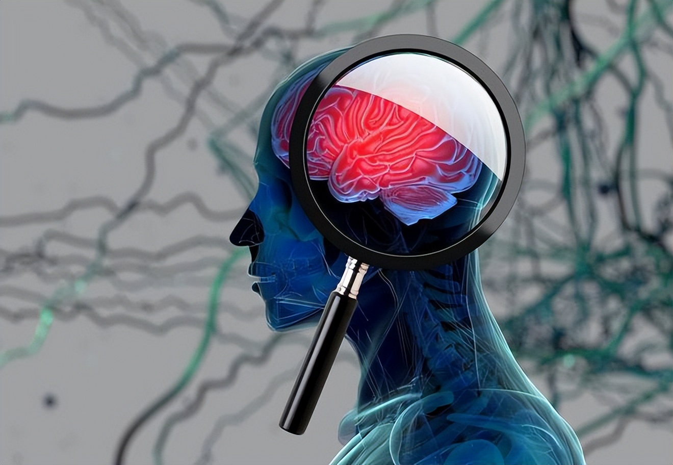 白发在后脑勺两鬓,两鬓和头顶白发后脑勺黑发