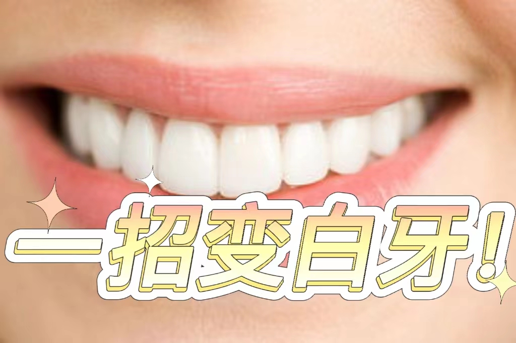 牙齿黄黑了怎么变白最简单的方法,大白牙怎么让牙齿变白