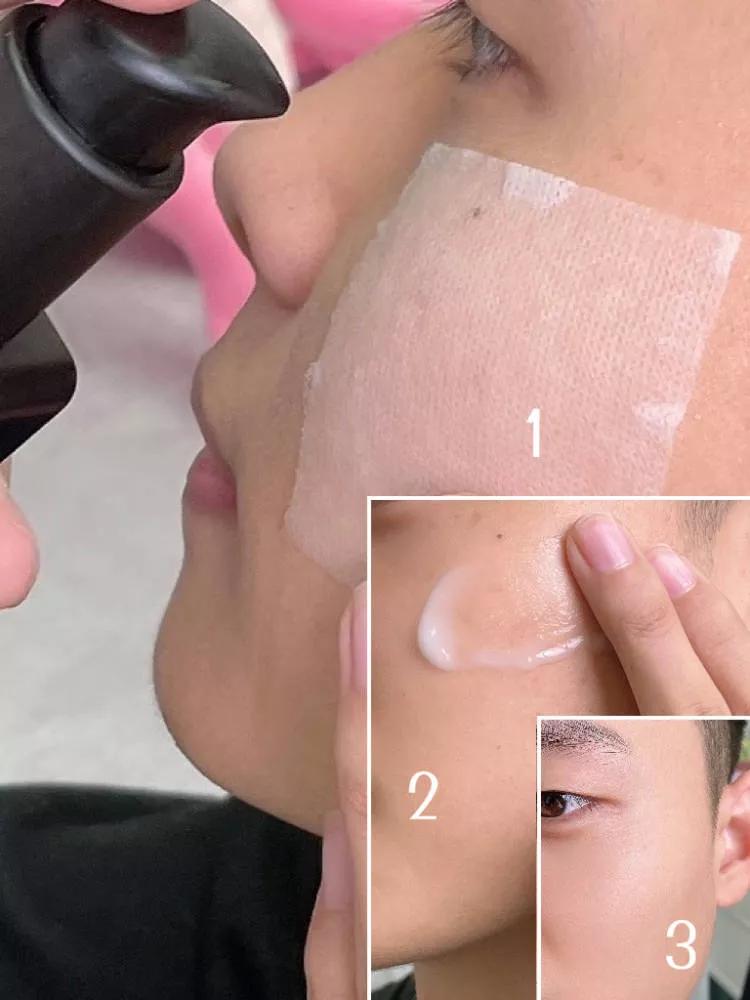 如何使闭口痘痘脸快速变好,只需三块钱的解决闭口粉刺小妙招