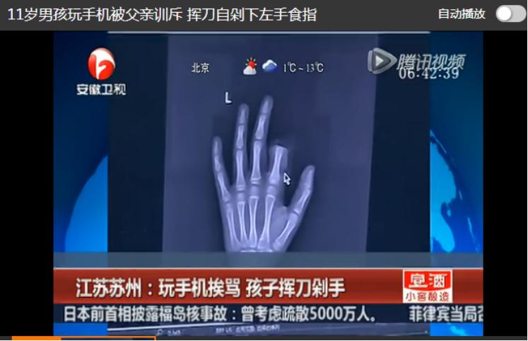 孩子故意划伤手,孩子被刀片划伤怎么办