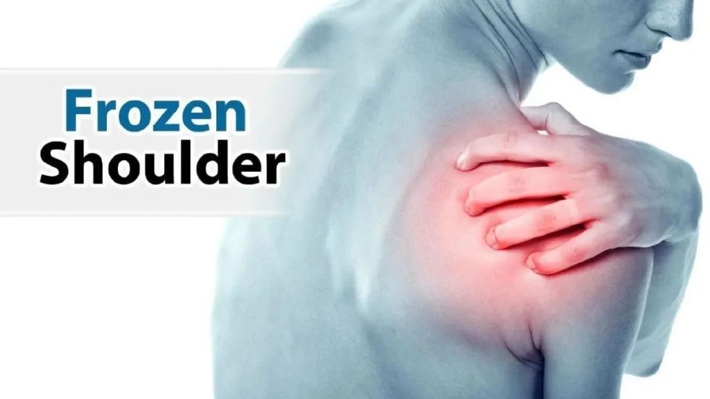 冻结肩怎么做康复治疗,冻结肩康复手法