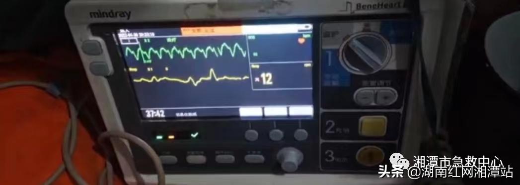 急救室40秒除颤,除颤30秒视频