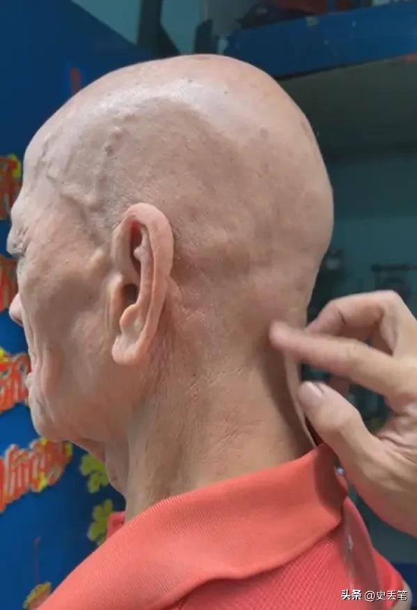 越南有位大爷从出生开始就浑身无毛，女友去世后他选择终身不娶
