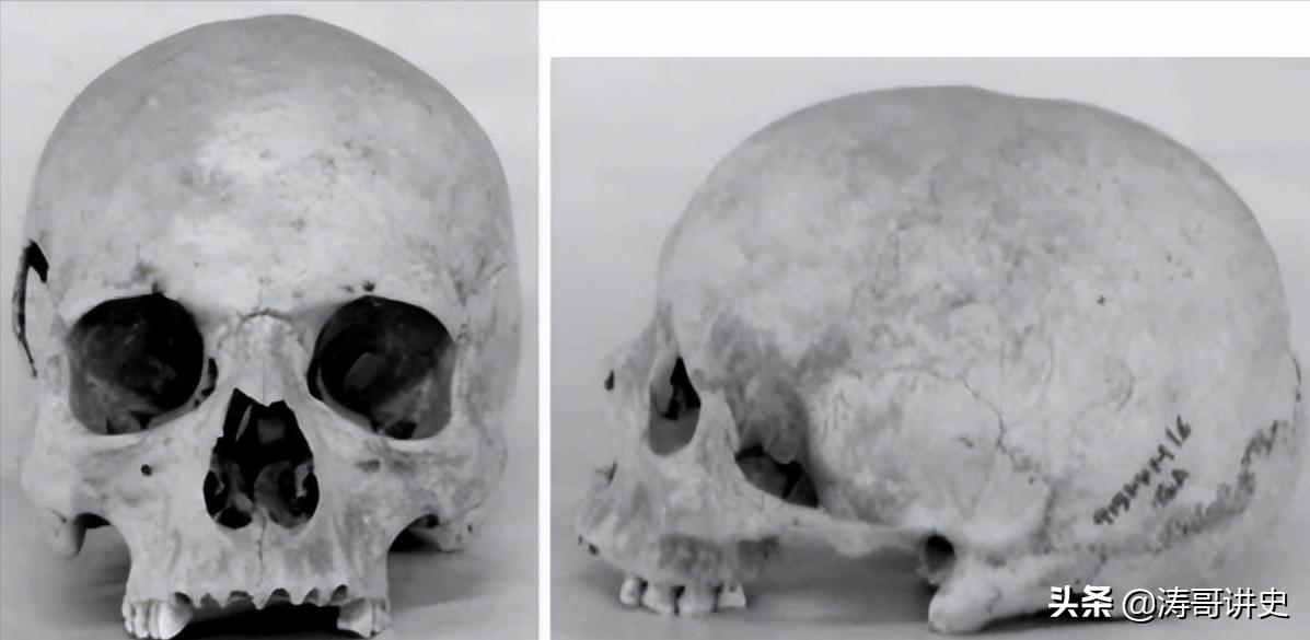殷墟发现白人遗骨,殷墟遗址出土白人头骨