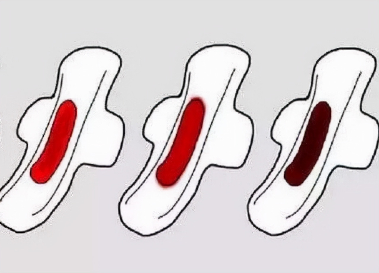 月经后一直有褐色分泌物是怎么了,为什么月经结束后有褐色分泌物