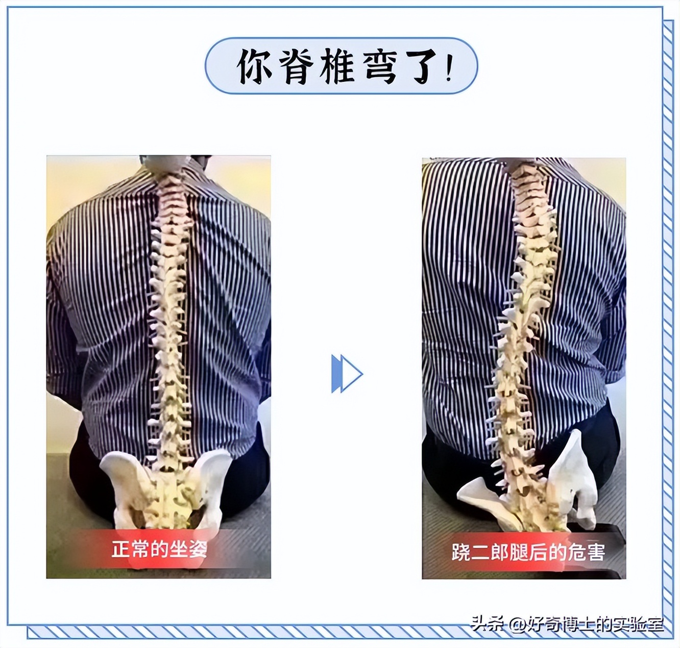 哪些姿势对腰部有损伤,哪种姿势对腰的伤害大