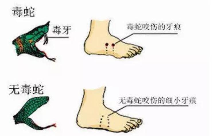 在野外遇到毒蛇怎么办,在野外遇到蟒蛇该怎么办