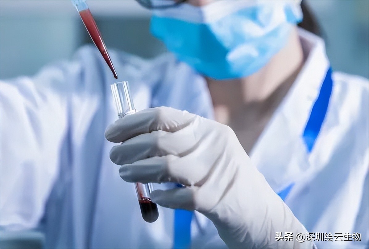 平常体检应该做哪些项目预防疾病,体检一般检查哪些项目入疾病筛查