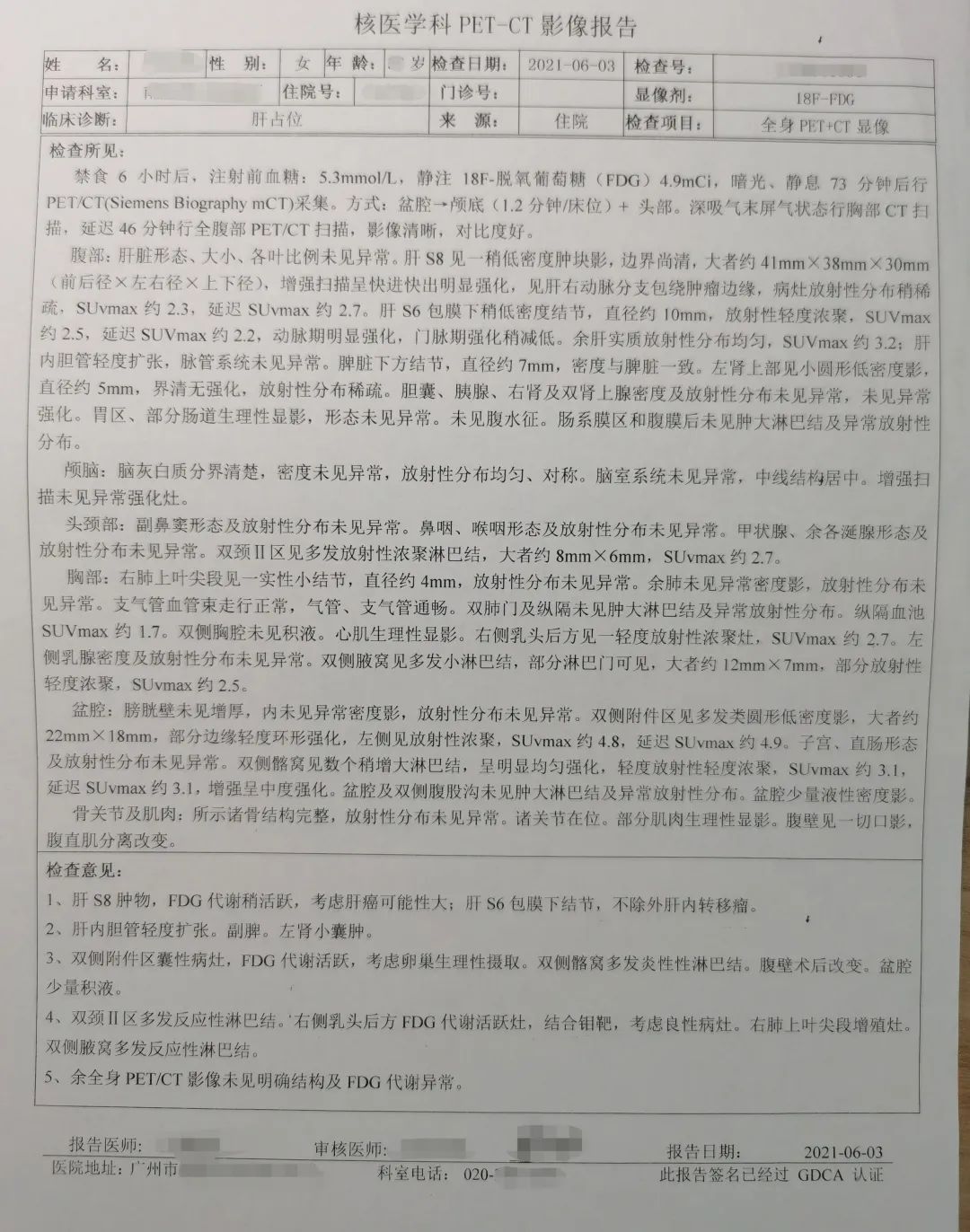 我的肚子中间有一条缝,我的肚子上为何有条竖线