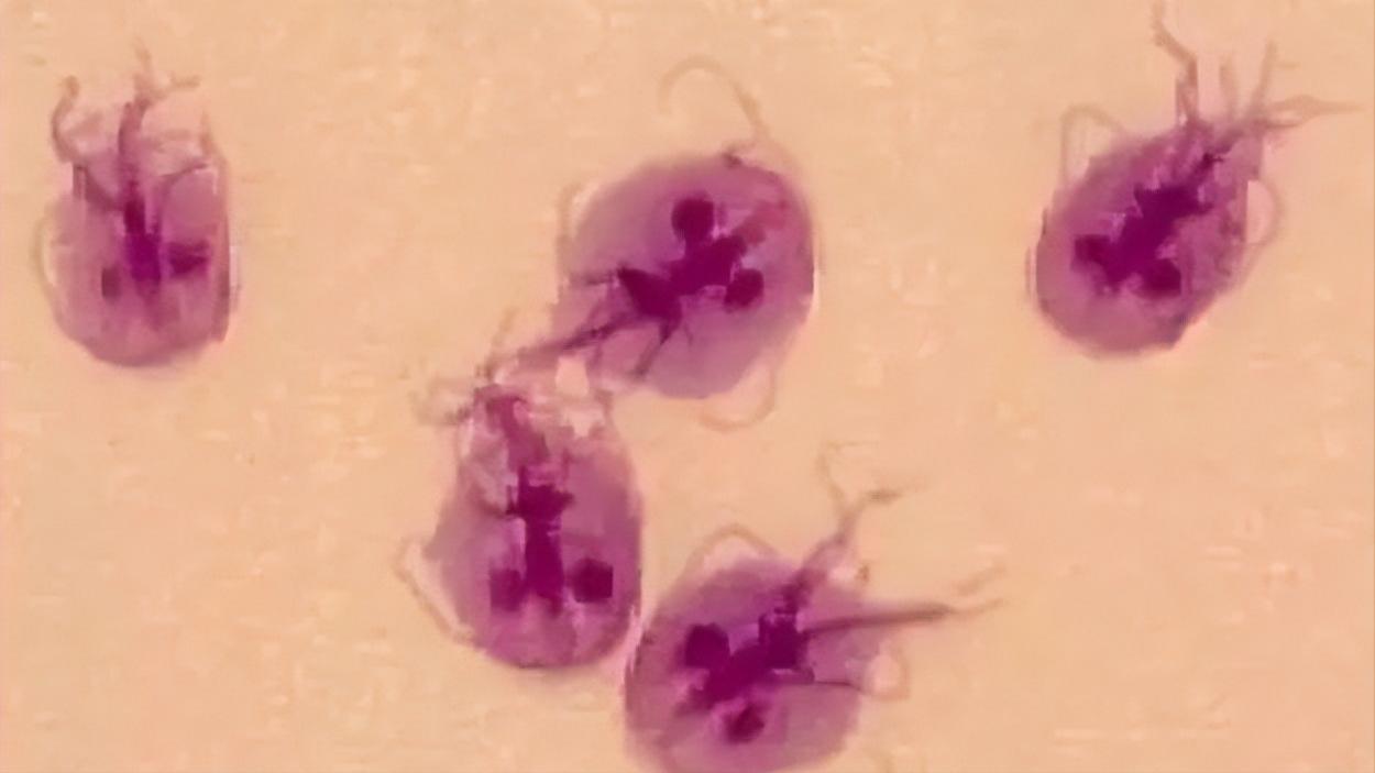 几块钱一瓶甲硝唑能治什么病,甲硝唑一瓶