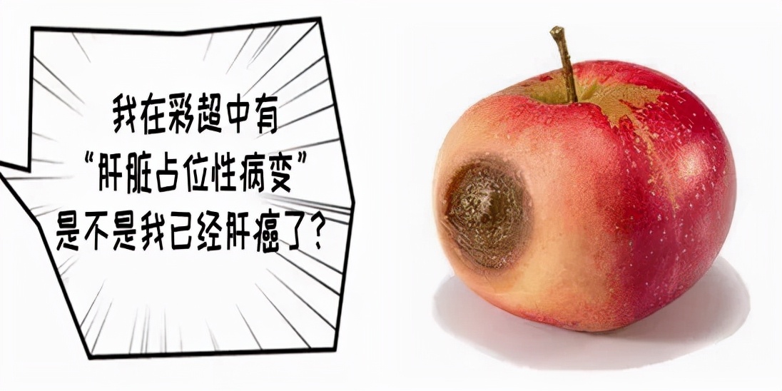 肝硬化性结节和弥漫性肝癌的区别,肝硬化肝内弥漫性占位