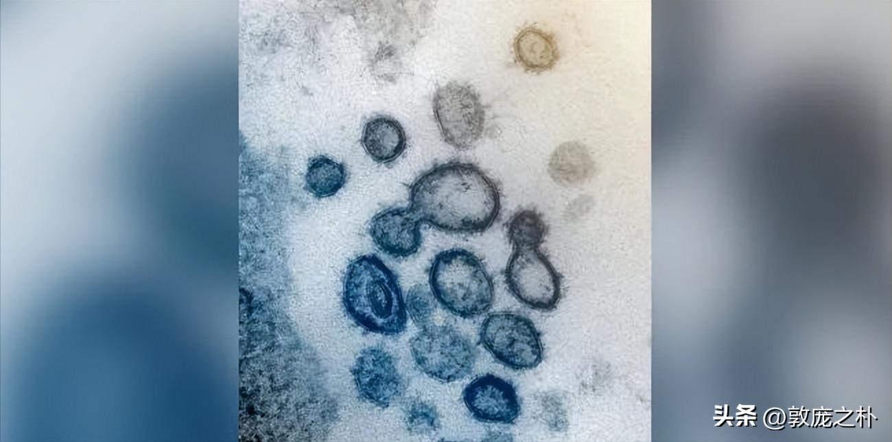 地球上十大可怕的病毒,地球上最厉害的十种病毒都是什么