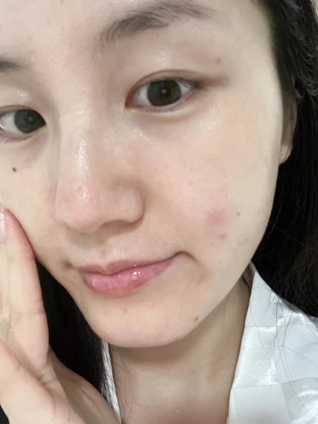 29岁脸上老是长痘痘是什么原因,脸上从来不长痘突然长痘怎么回事