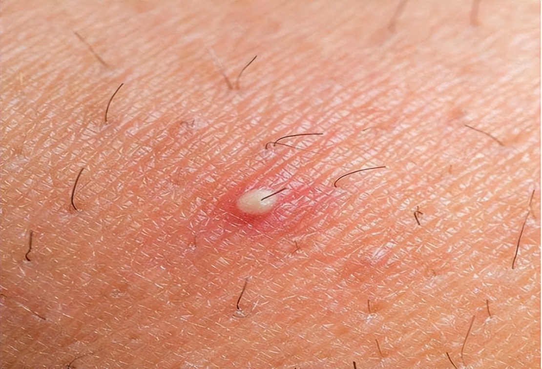 如何在生理上判断男性是否出轨,怎样从生理上看出男人有没有出轨