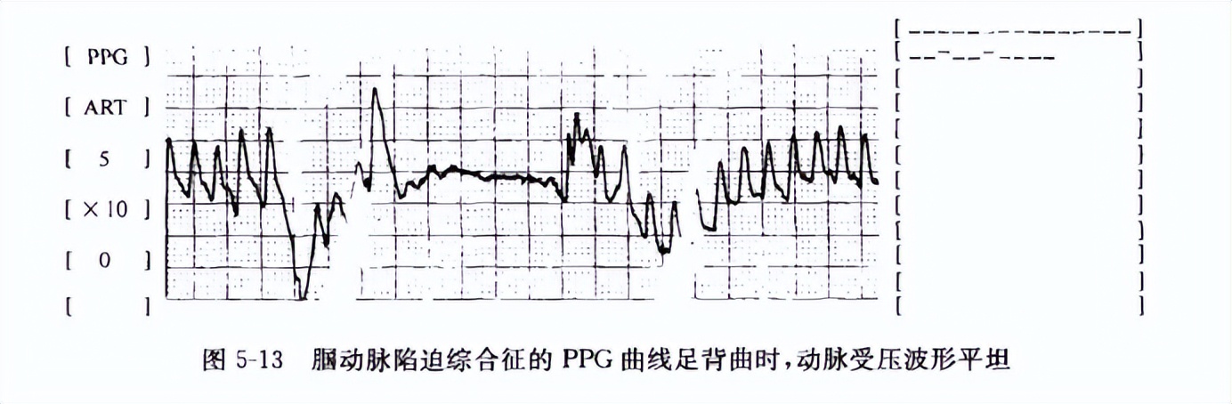 有关血管外科学的书推荐,血管外科临床解剖学第2版