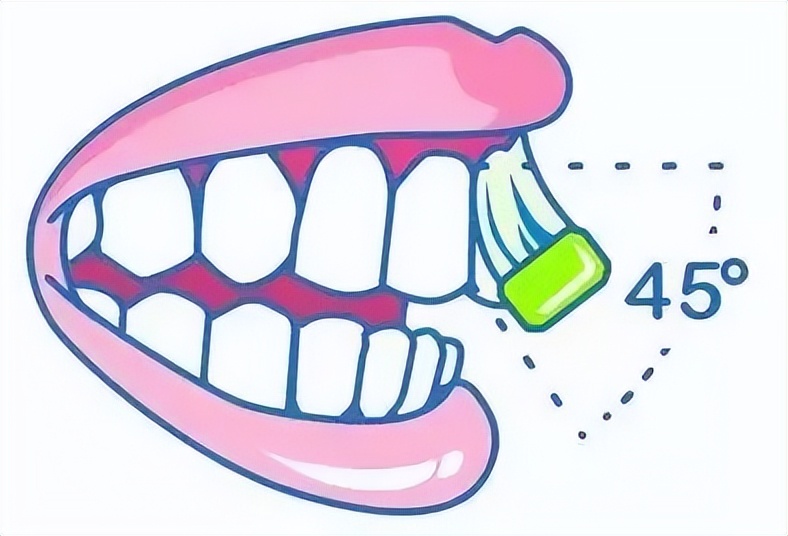 牙龈肿痛出血是什么原因引起的,牙龈上火出血用什么牙膏好