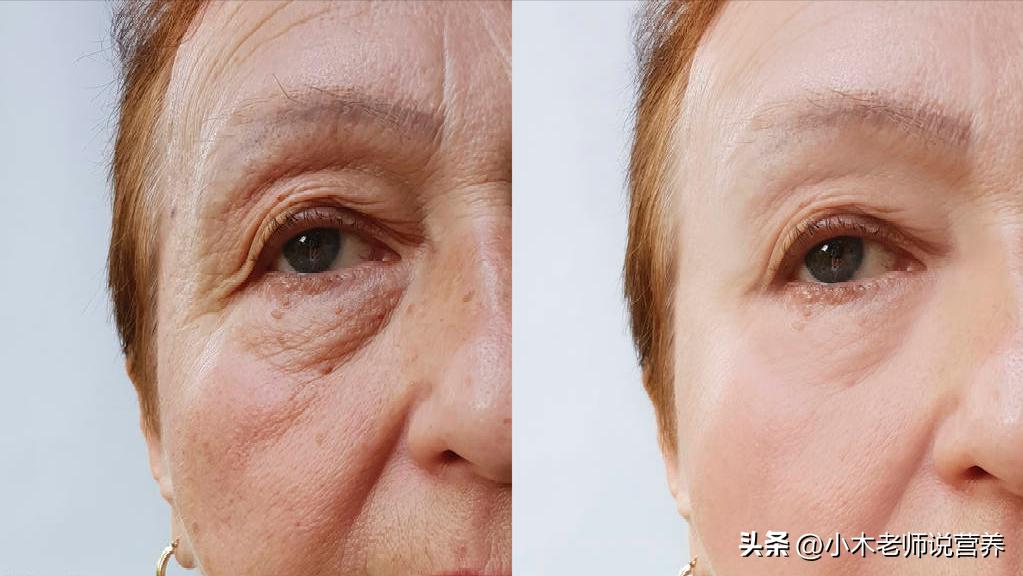 多吃这八种水果提高记忆力,大人吃增强记忆力的水果有哪些