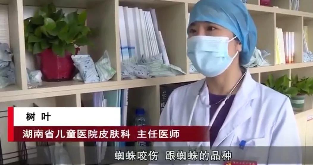 被毒虫咬后需谨慎,被毒虫咬后的有效处理