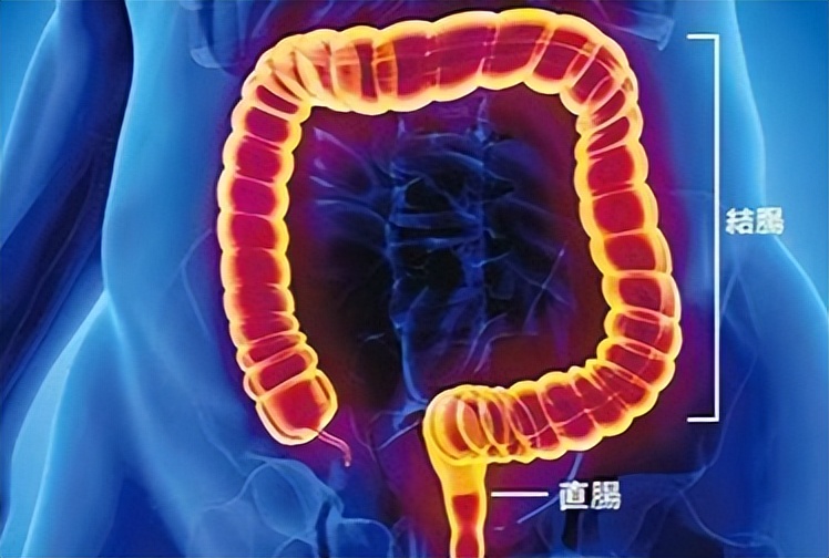 结直肠癌一般发病年龄,结直肠癌的诱因及病因