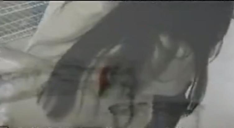 嗜酒如命的男人70岁,48岁大叔一天3斤酒