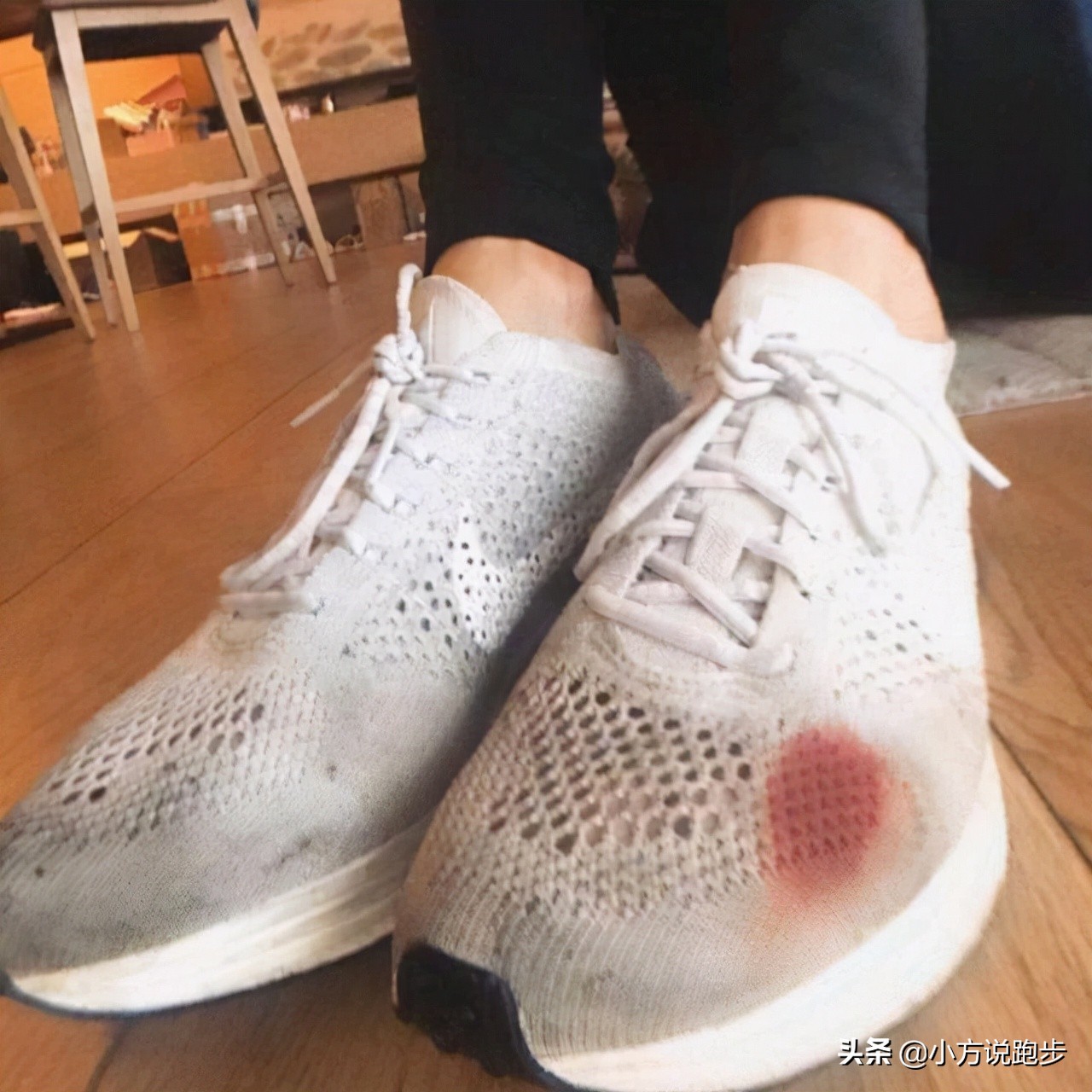 跑步鼻子出血是什么原因,跑步跑出血是怎么回事