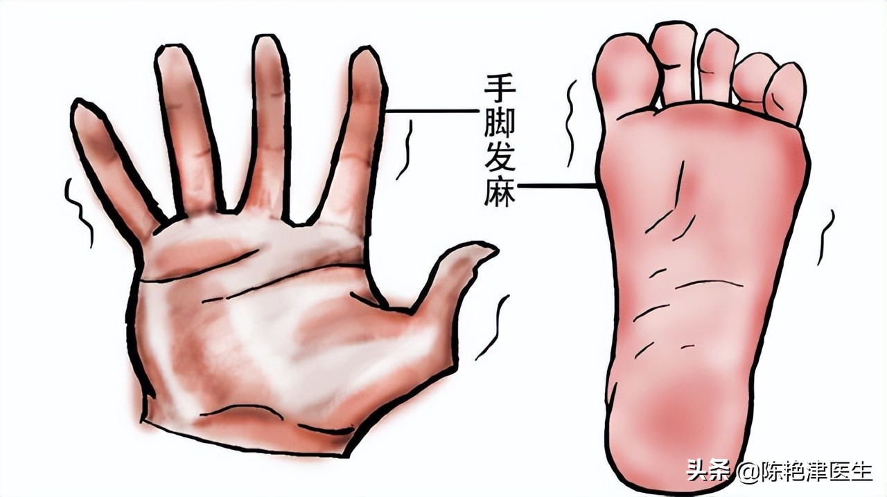 突发脑梗的五个信号,脑血栓脑袋滋滋的声音