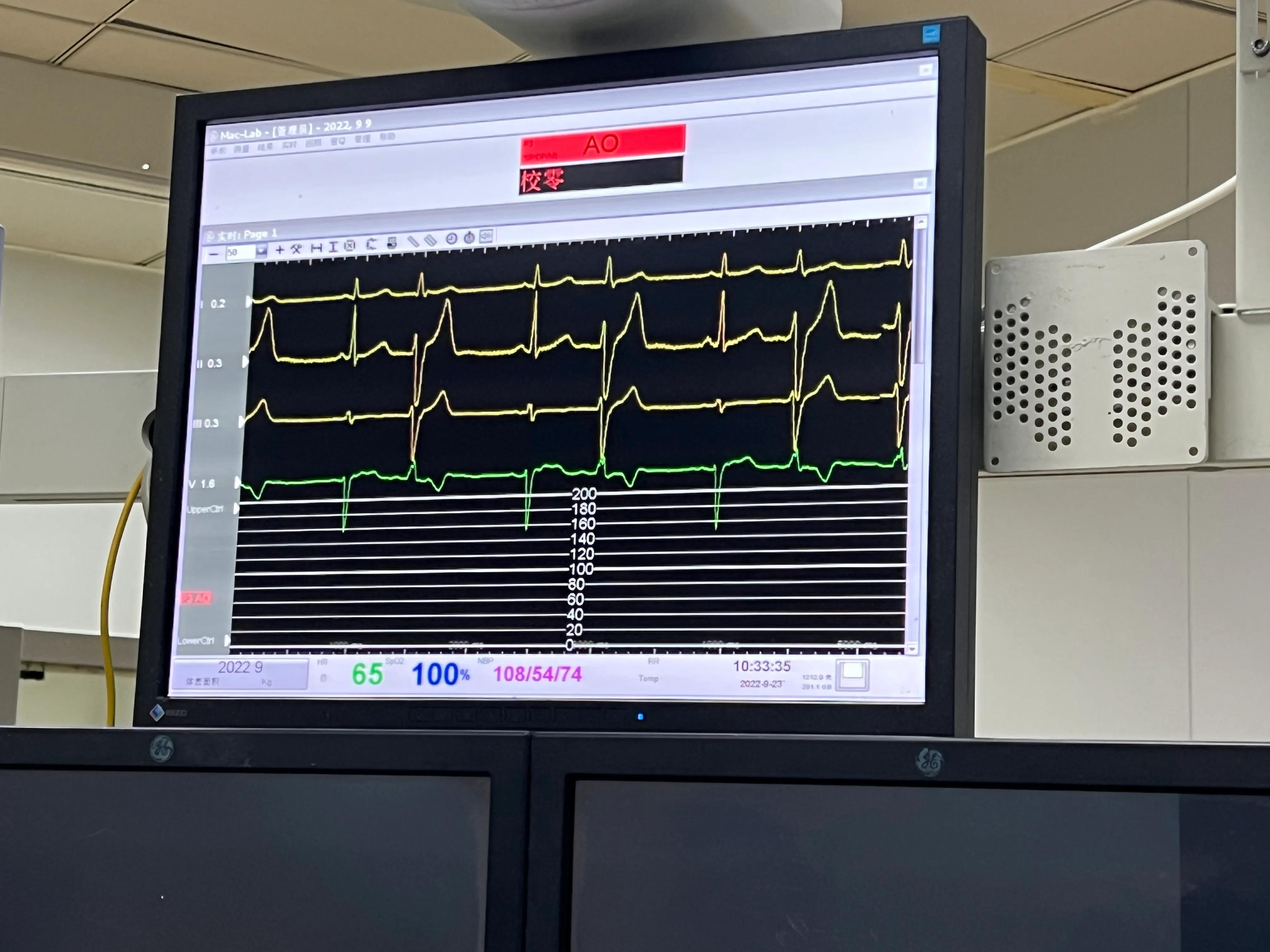 胸闷气促病例分析,小孩胸闷气短去检查说有炎症