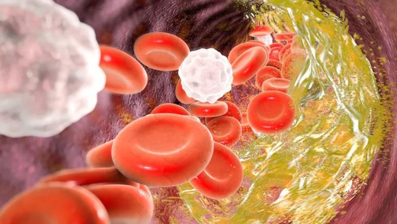 花生是心血管病的克星还是营养品,花生是心血管的祸根还是福音