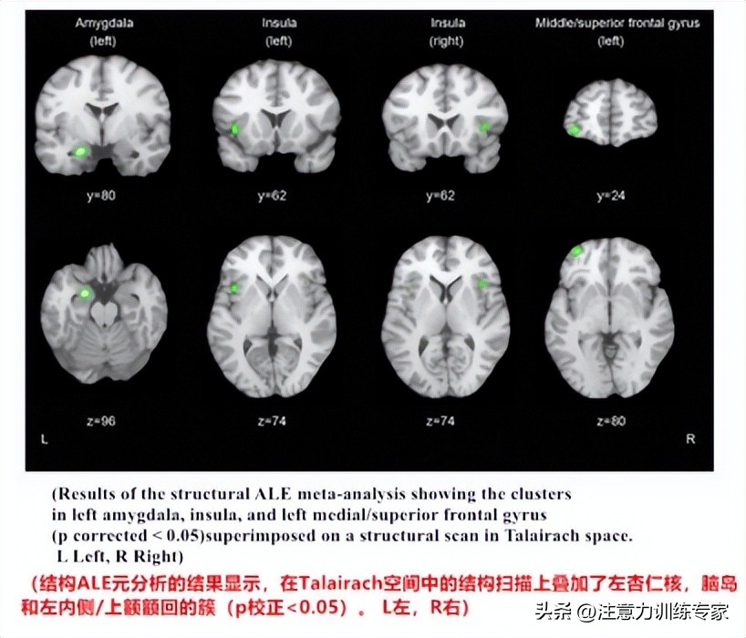 A娃易怒顶嘴，爱攻击.小心对立违抗障碍！4种方法，有效改善症状
