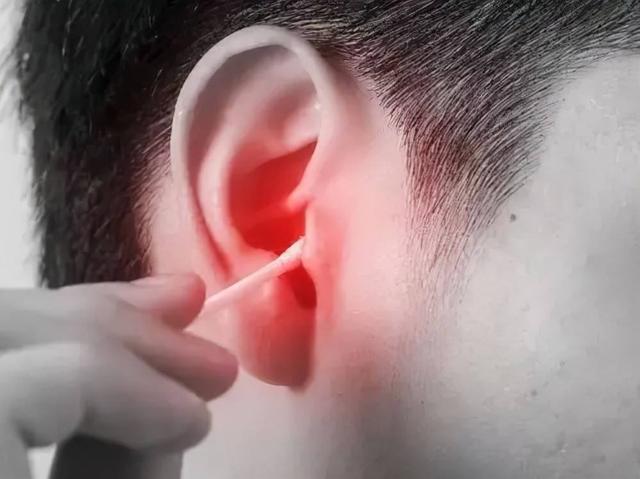 为什么有人耳屎是干的有的是湿的,为啥有人的耳屎是湿的