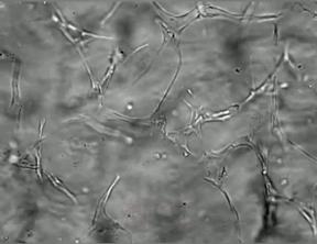 崴脚怎么知道复位了,崴脚别慌4招教你快速康复