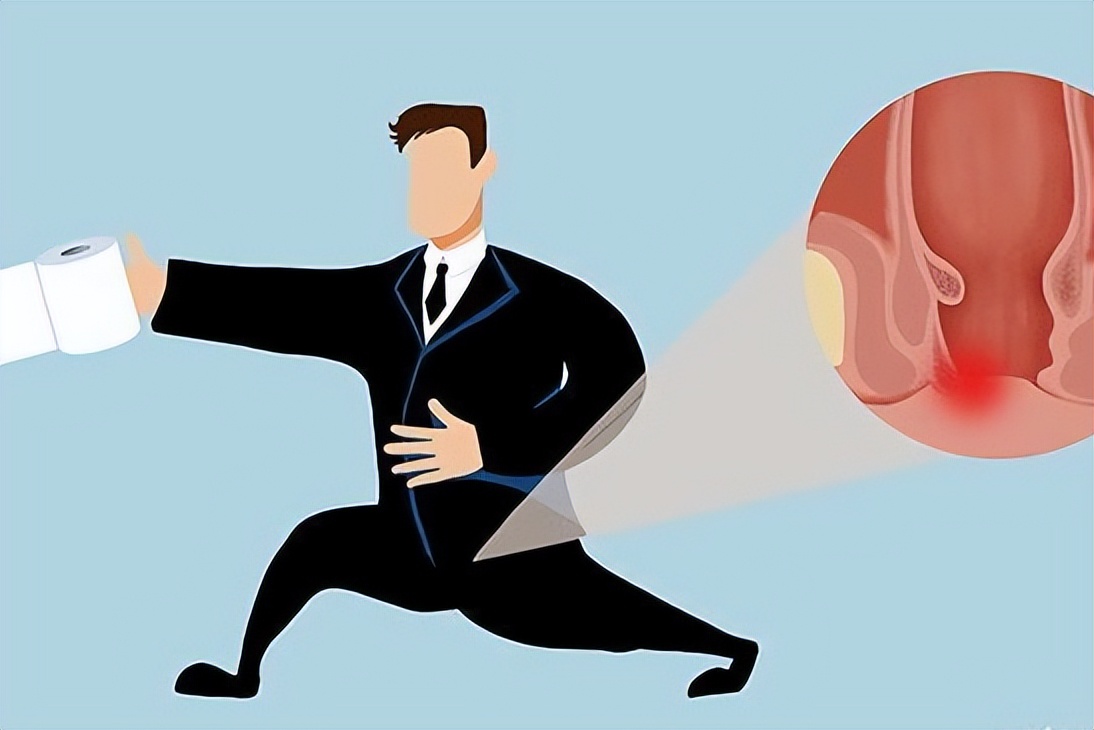 坚持缩肛运动的好处,坚持运动对男性有什么好处