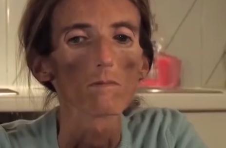 身高一米七140斤怎么减肥,身高一米七体重74公斤怎么减肥