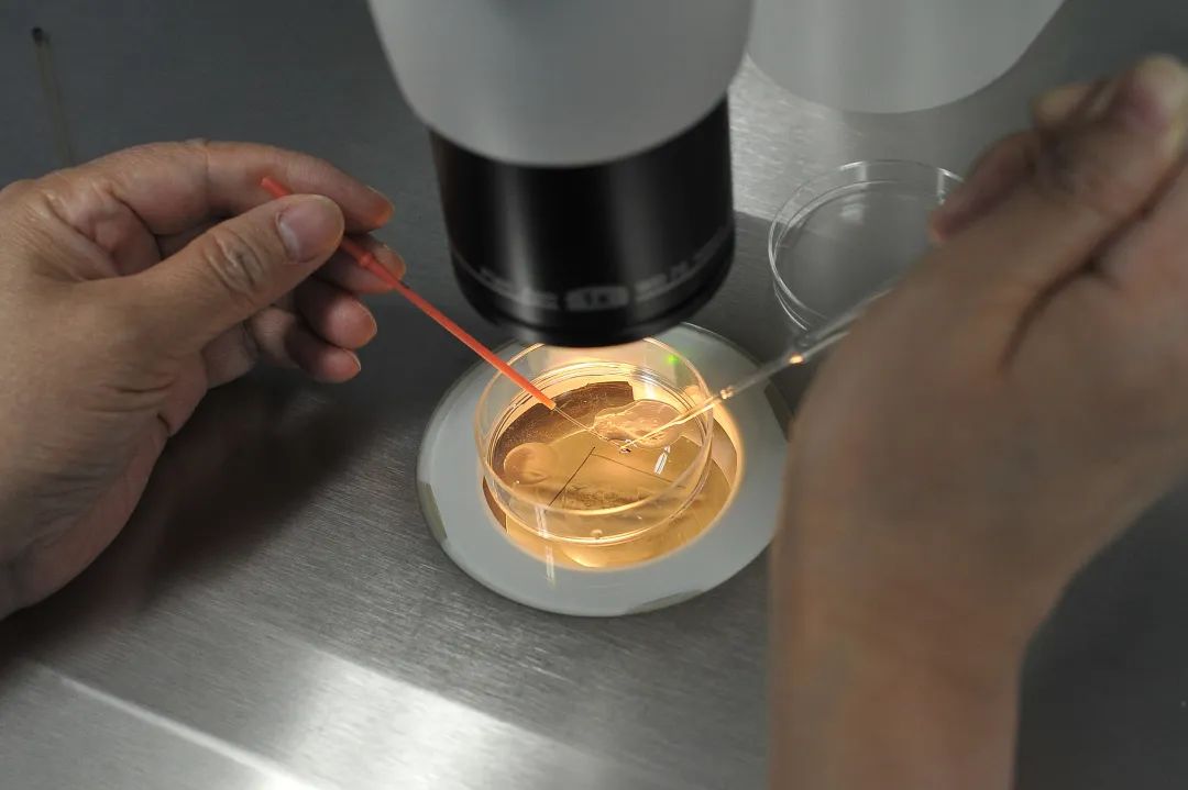 35岁卵巢像40多岁,30岁卵巢像40多岁