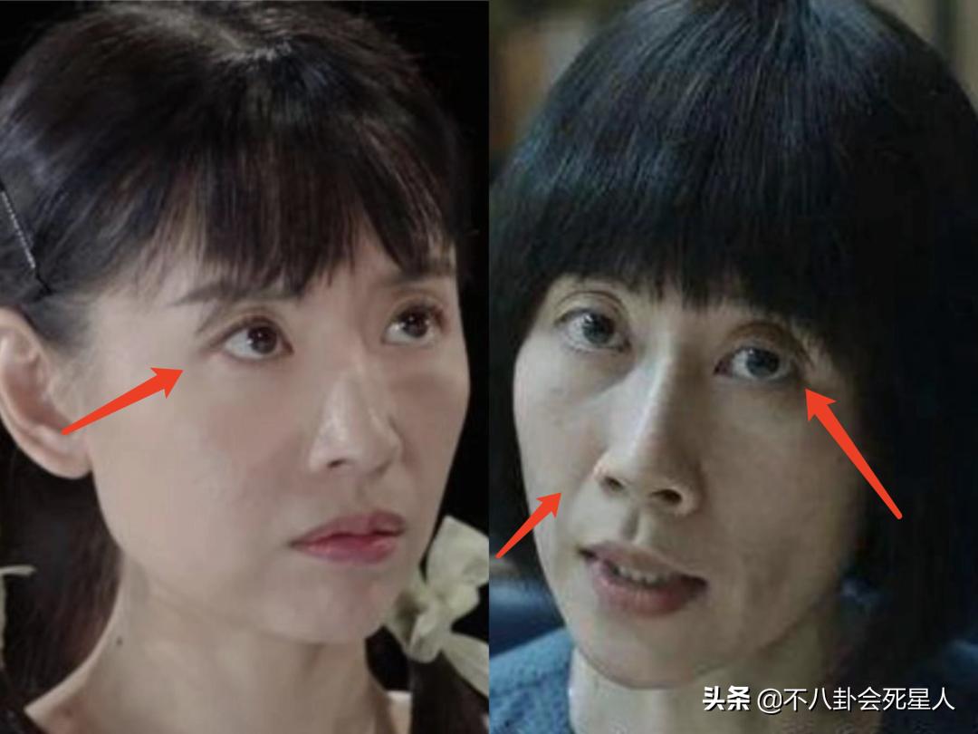 瘦脱相式衰老的7位女明星,瘦脱相的女孩子