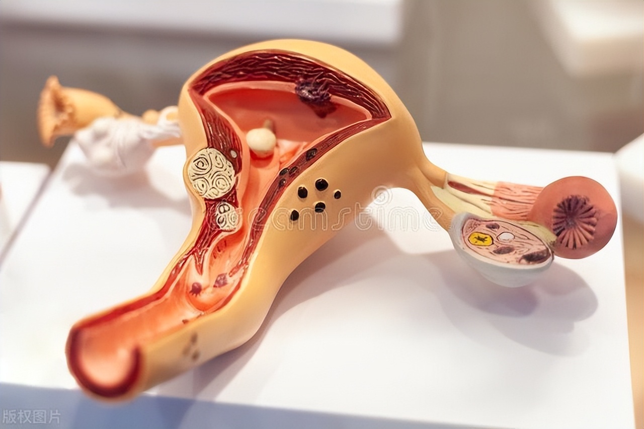 别拿阴道干涩不当回事，这些危害很难应对，教你几招解决问题